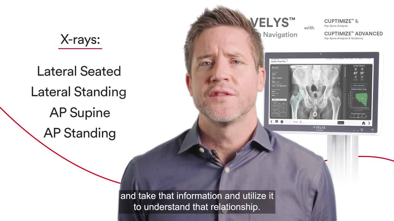 What is CUPTIMIZE™ Advanced Video with Dr. Joseph Gondusky