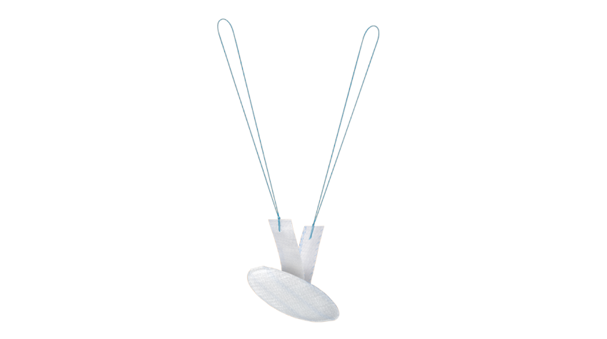 PROCEED® Ventral Patch