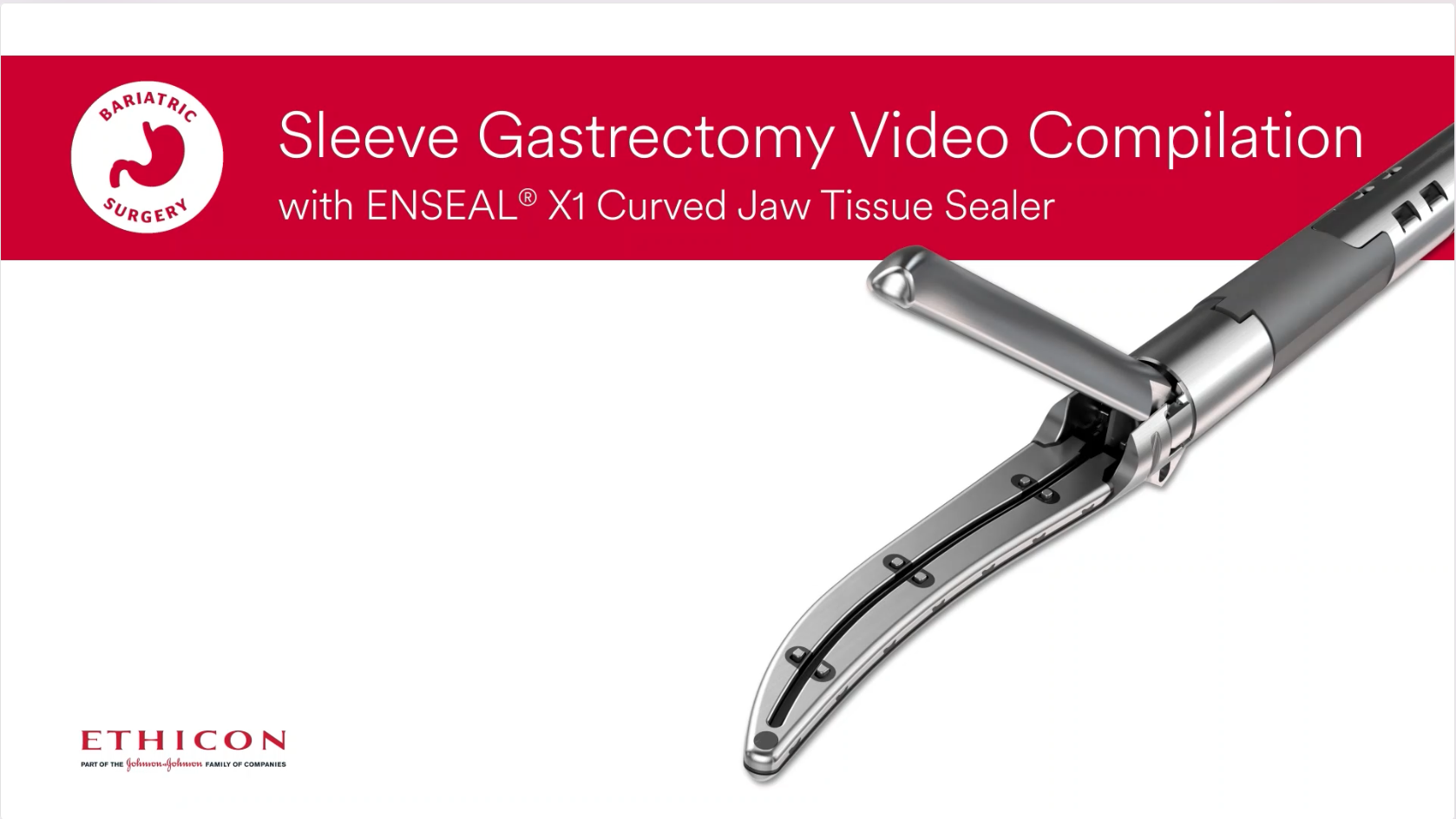 Enseal® X1 Curved Jaw Dr Radecke LSG Montage