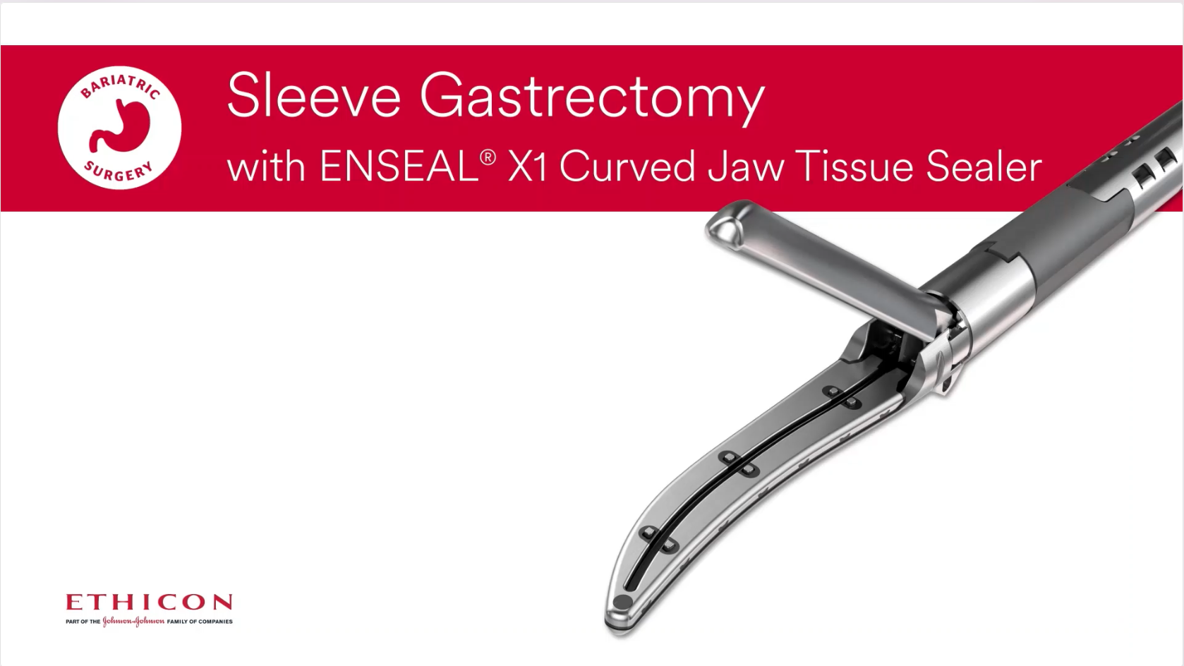 Enseal® X1 Curved Jaw Dr Radecke_Sleeve Video