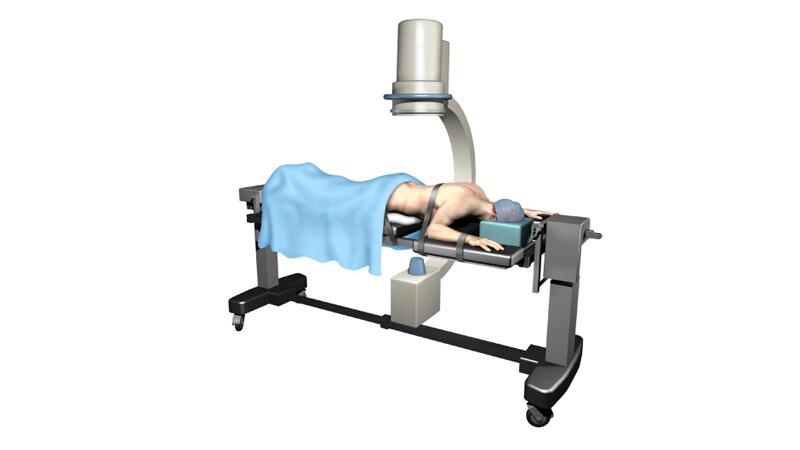 patient lying under c-arm for fluoroscopic planning