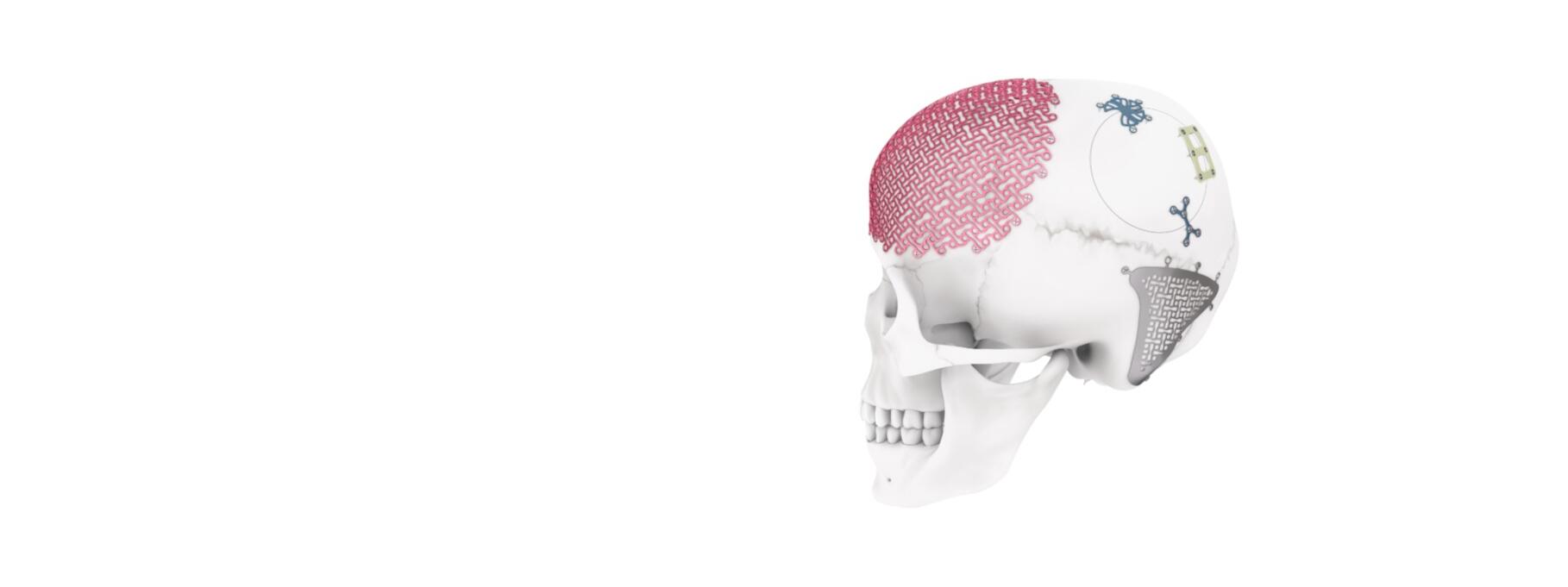 MatrixNEURO shown on a skull