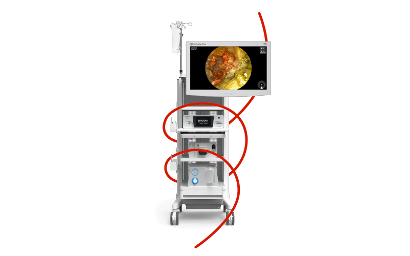 TELIGEN™ System